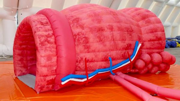 cancer masculin prostate montpellier 34 Occitanie